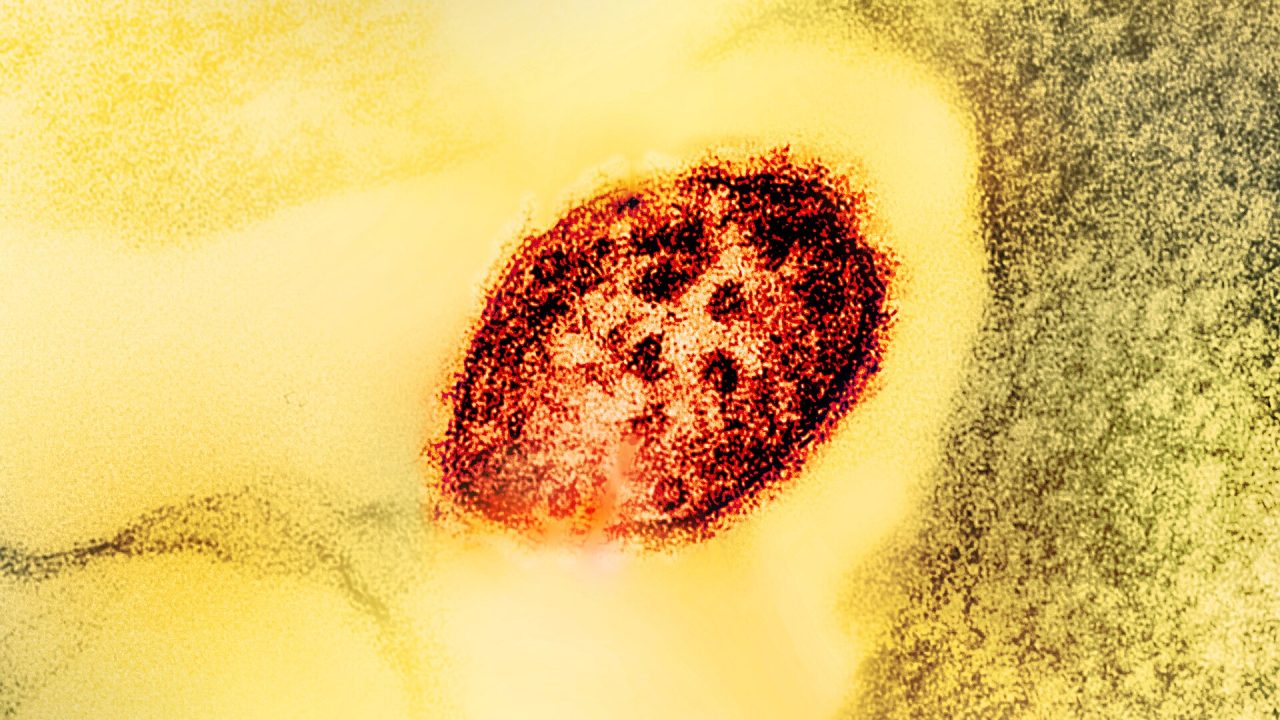 Colorized transmission electron micrograph of a measles virus particle (red).