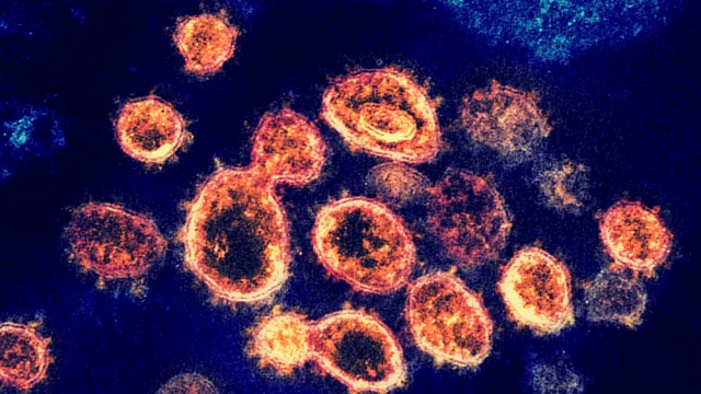SARS-CoV-2 (µ-IMAGE) vaccines mRNA-1273 (moderna), Ad5 (CanSinoBio, NantKwest ImmunityBio), ChAdOx1 nCoV-19 (Oxford universi…
