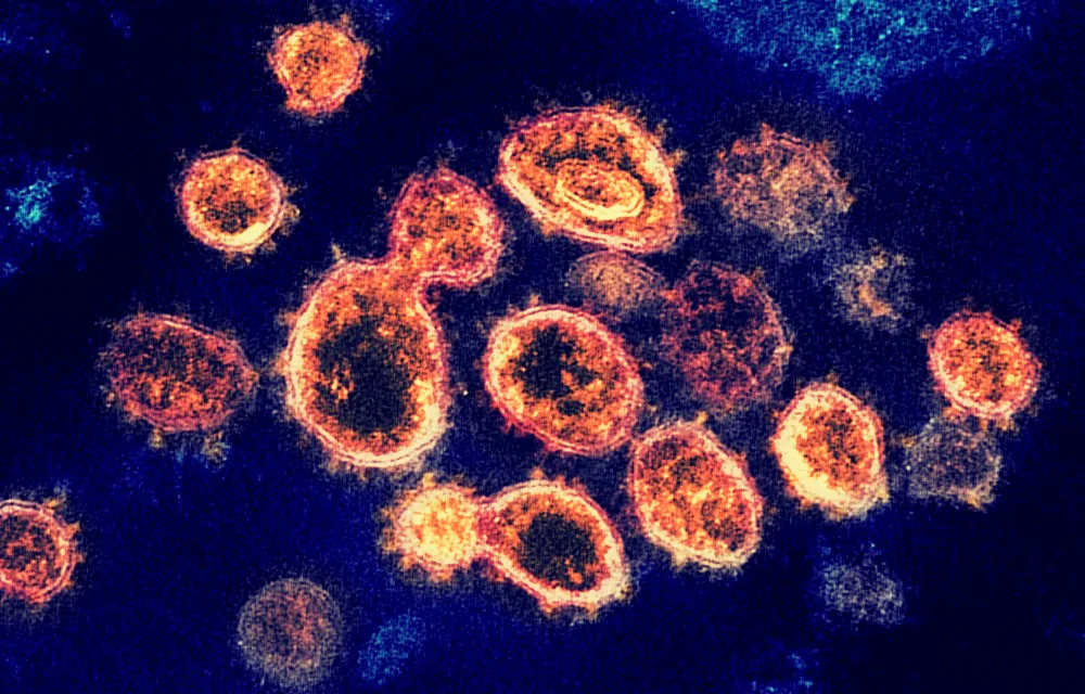 SARS-CoV-2 (µ-IMAGE) vaccines mRNA-1273 (moderna), Ad5 (CanSinoBio, NantKwest ImmunityBio), ChAdOx1 nCoV-19 (Oxford universi…