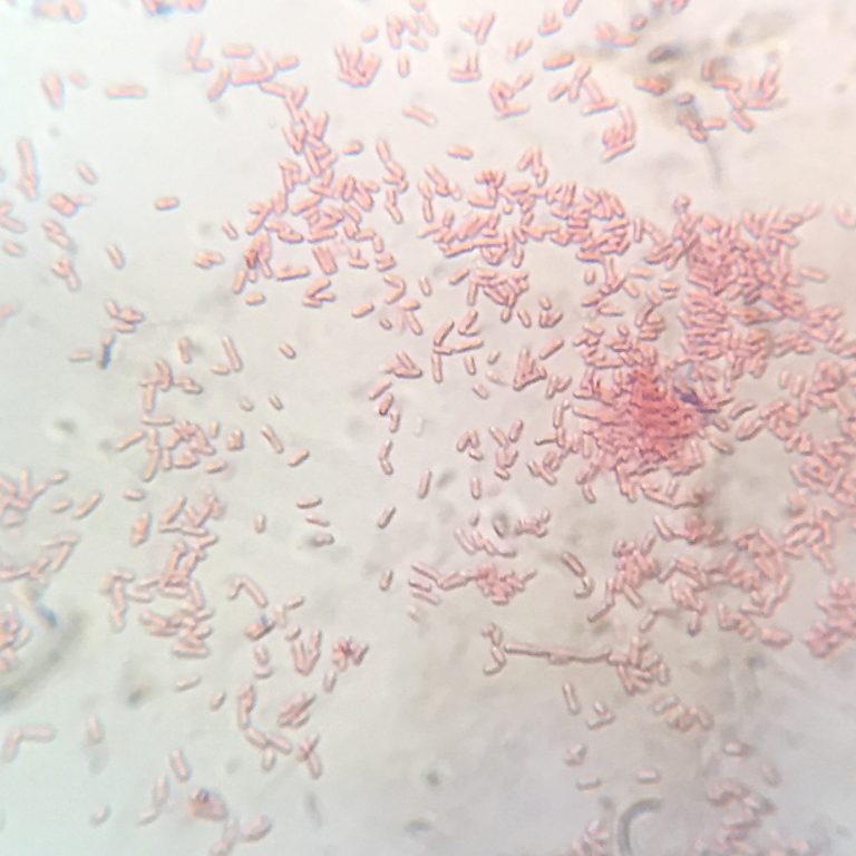 A gram stain of gram negative (-), rod-shaped Shigella flexneri bacteria on microscope slide.